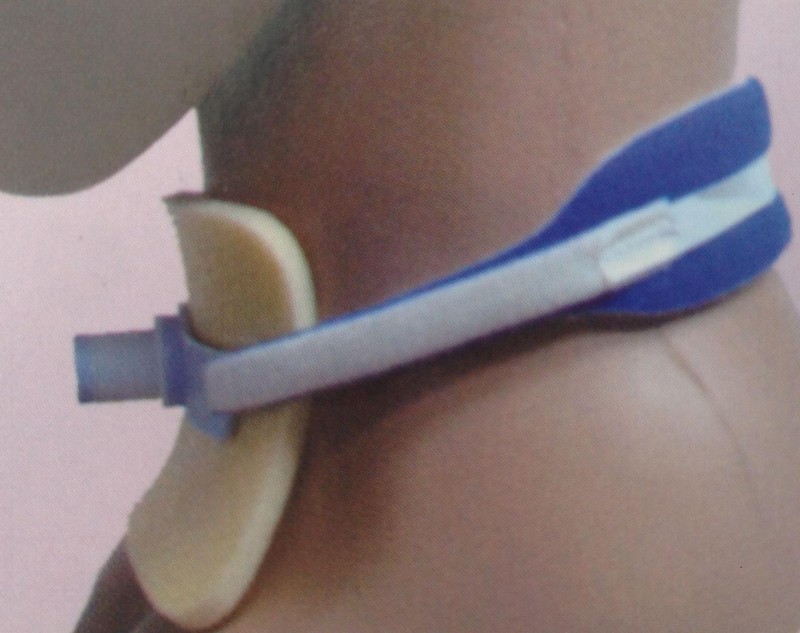 導(dǎo)管固定裝置