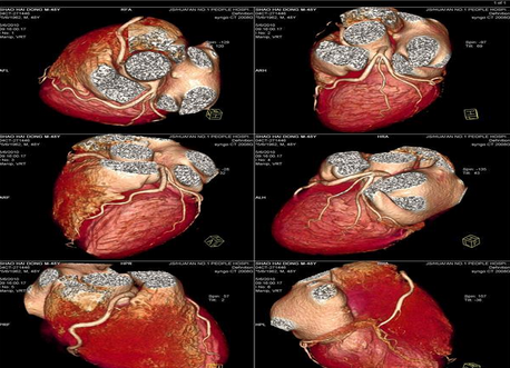 醫(yī)用干式膠片（噴墨 藍(lán)基 膠片）