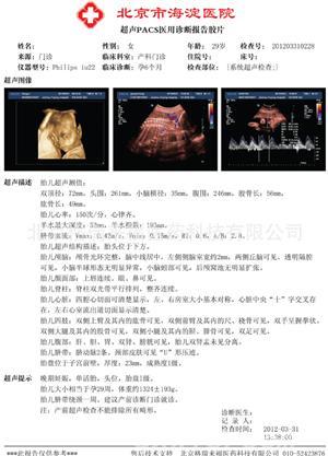 醫(yī)用打印膠片招商