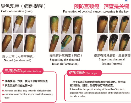 醫(yī)保產品： 宮檢1號 （宮頸癌快速篩查）