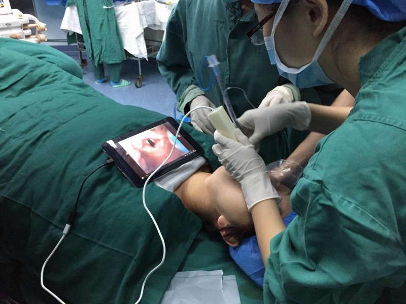 一次性可視喉鏡（一次性氣管導(dǎo)管用可視內(nèi)窺喉鏡）