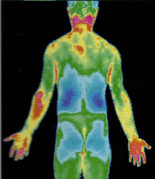 北京醫(yī)用紅外熱像儀 醫(yī)用紅熱成像檢測儀 醫(yī)院專供