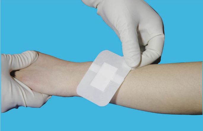 怡敷康無菌敷料