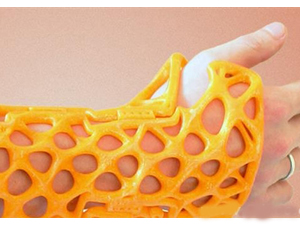 骨科新技術(shù)——3D打印手術(shù)夾板、支具