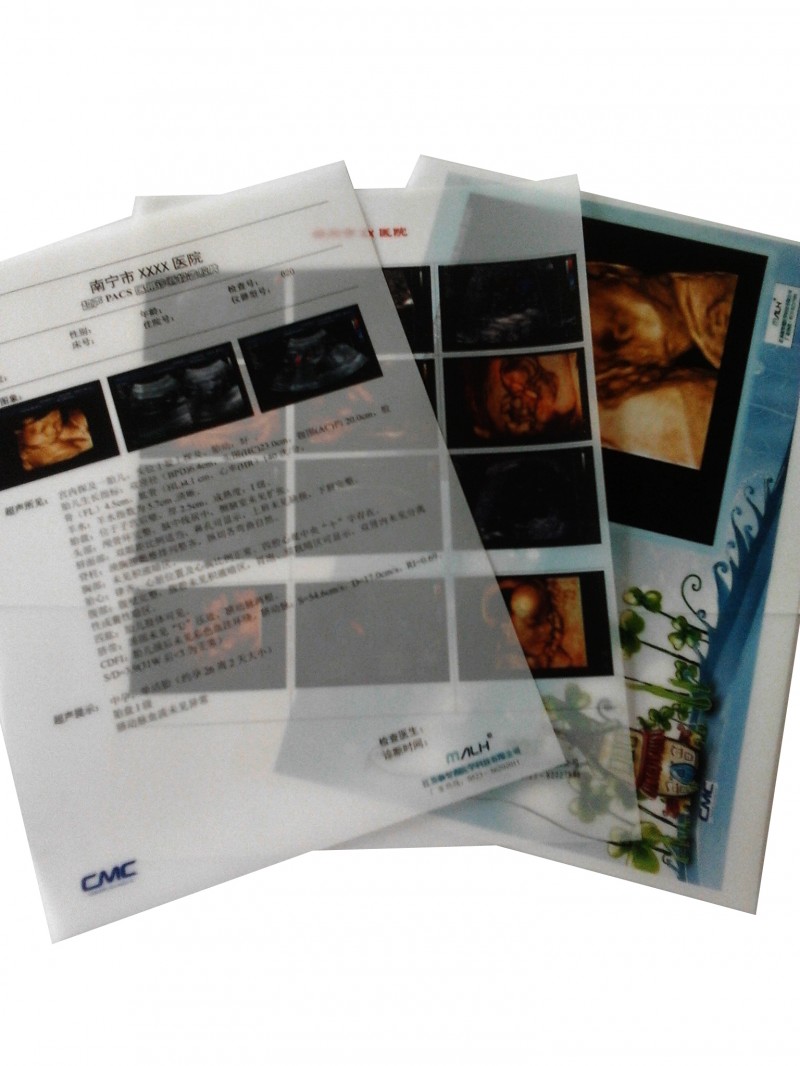 醫(yī)用打印膠片（商品名：超聲PACKS醫(yī)用診斷報告膠片）