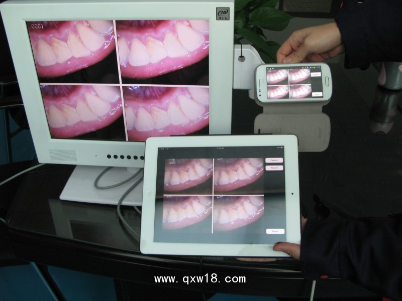 M-958AWI-FI口腔內(nèi)窺鏡一體機(jī)+15寸高清顯示器
