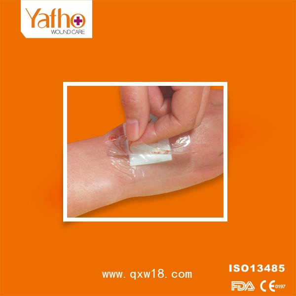 防水敷料 透明敷料 多規(guī)格