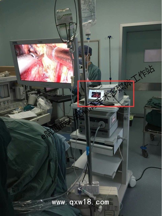 GK309內窺鏡嵌入式手術多媒體工作站