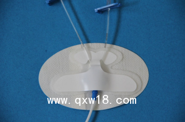 PICC導(dǎo)管固定裝置