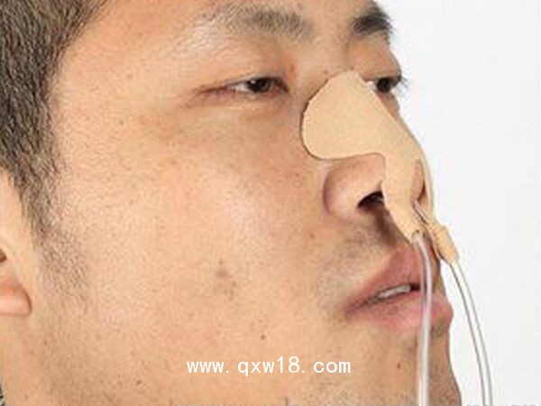 醫(yī)用導管夾 導管固定帖（鼻飼管固定貼） G型大