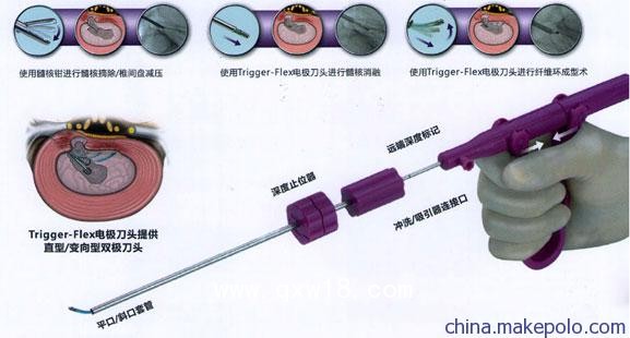 椎間孔鏡用射頻消融刀頭