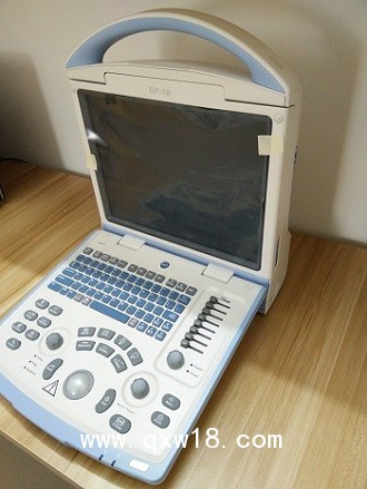 DP-10全數(shù)字便攜式超聲診斷儀黑白B超手提式