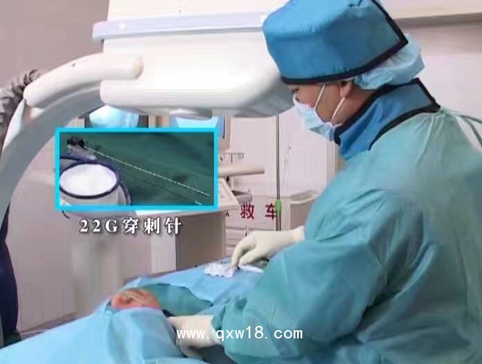 射頻熱凝器 北琪射頻 疼痛治療儀