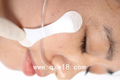 醫(yī)用導(dǎo)管夾 導(dǎo)管固定帖（鼻飼管固定） A型小