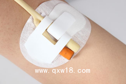 醫(yī)用導(dǎo)管夾 導(dǎo)管固定帖（導(dǎo)尿管固定） C型