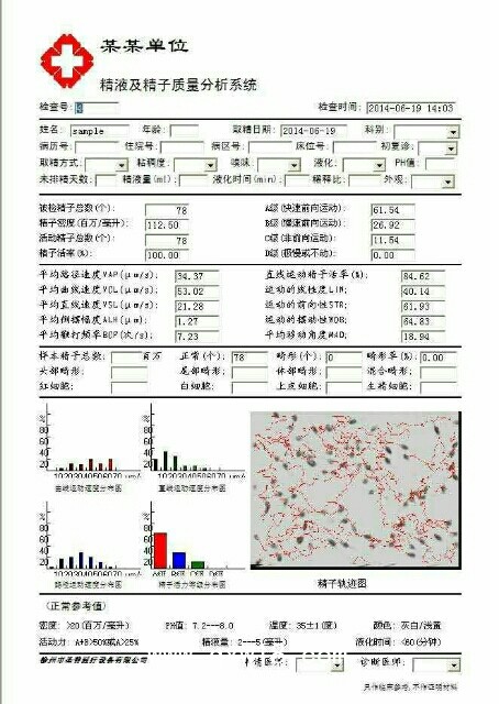 精子質(zhì)量分析儀  SPJ-1  （標(biāo)配、高配）