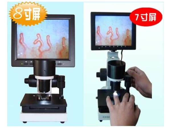 微循環(huán)檢測儀 微循環(huán)檢測儀招商