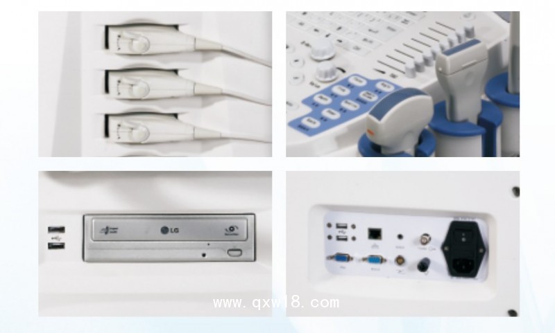 彩色超聲恩普3000型彩色多普勒超聲診斷系統(tǒng)