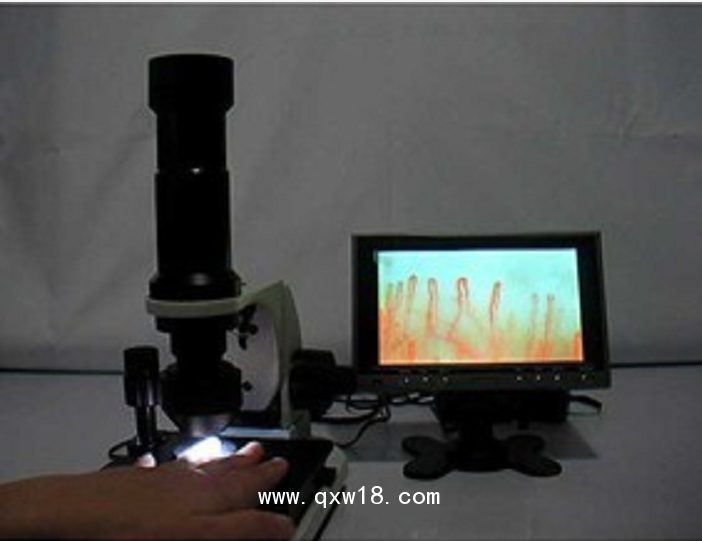 微循環(huán)檢測儀