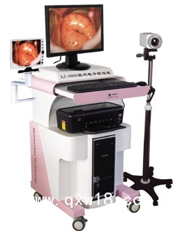 陰道鏡，高清陰道鏡，電子陰道鏡