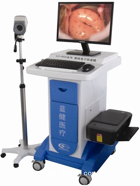 陰道鏡，高清陰道鏡，電子陰道鏡