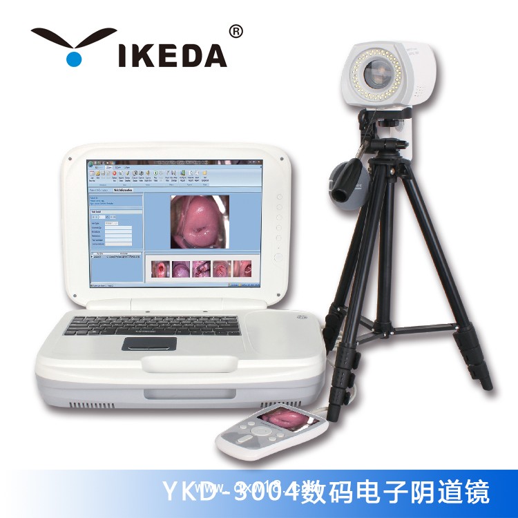 供應紅外乳腺檢查儀|內(nèi)窺鏡攝像機|數(shù)碼電子陰道鏡