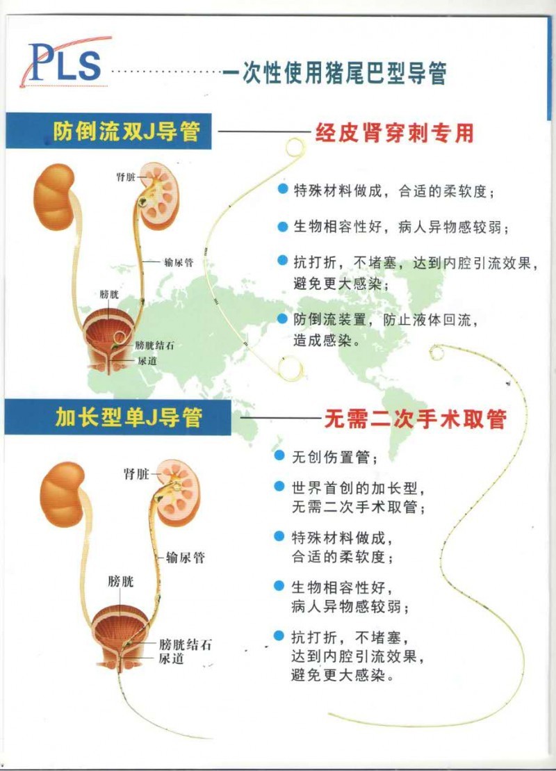 豬尾巴（雙J單J）導管