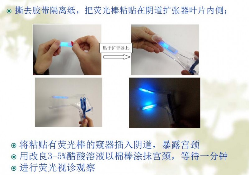 陰道熒光檢查棒