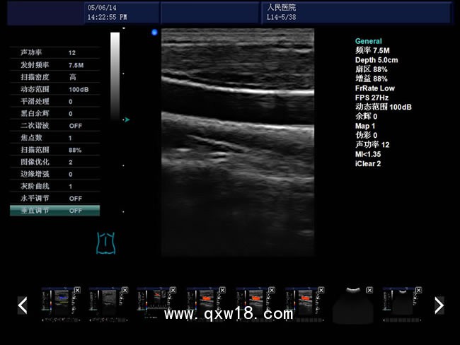 b超機(jī) 彩色b超機(jī) 心臟b超機(jī) 國(guó)產(chǎn)高端b超機(jī) 腹部乳腺b超