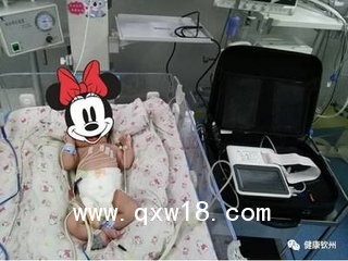 新生兒心電圖機