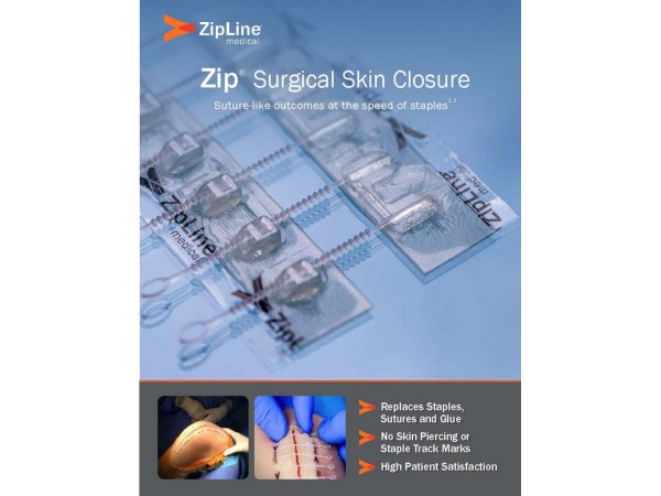 捷膚聯(lián)無(wú)創(chuàng)高強(qiáng)度皮膚縫合器