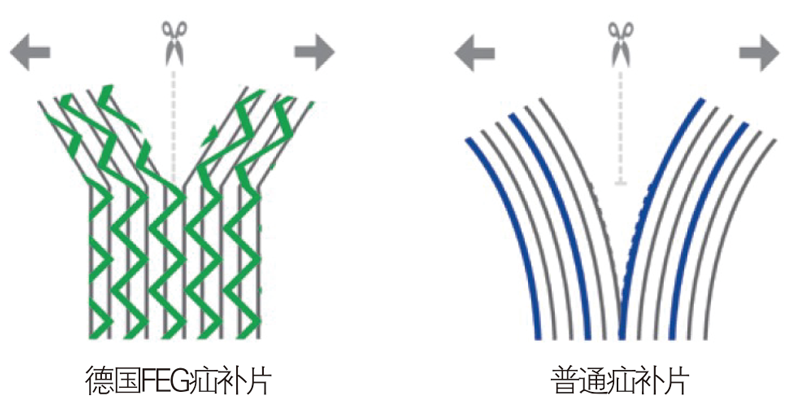 德國PVDF材質(zhì)疝氣補片-IPST