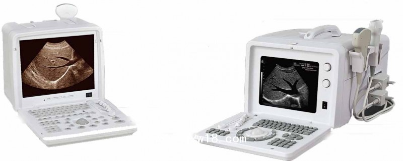 全數(shù)字B型超聲診斷儀（黑白B超）