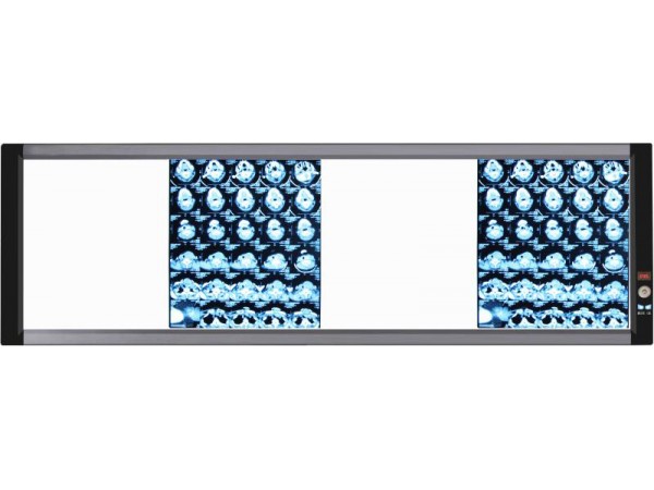 山東眾佳ZJ-G4B 系列LED醫(yī)用超薄液晶觀片燈