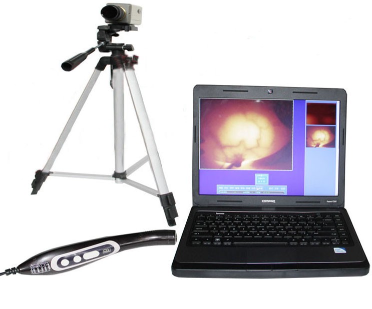 供應(yīng)乳腺病檢測分析儀（紅外線乳透機(jī)）