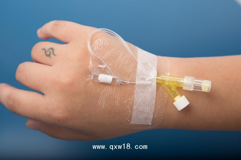 導(dǎo)管固定裝置