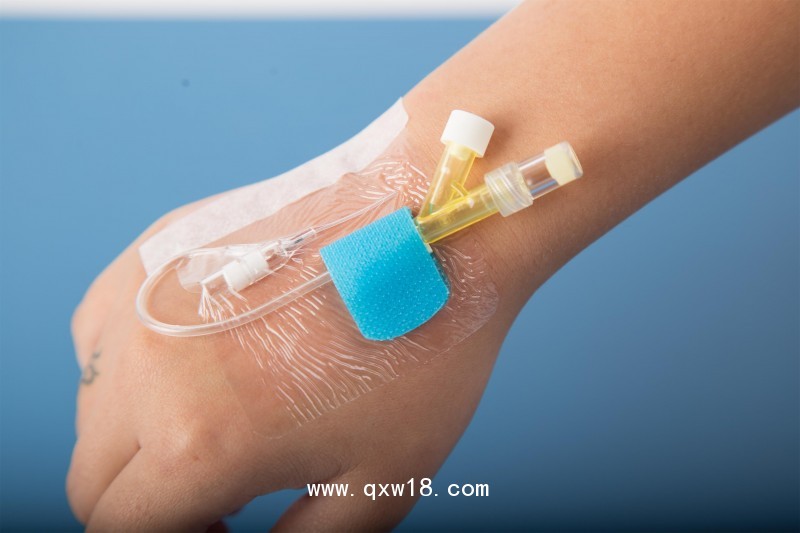 導(dǎo)管固定裝置