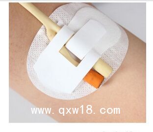 體表導(dǎo)管固定裝置