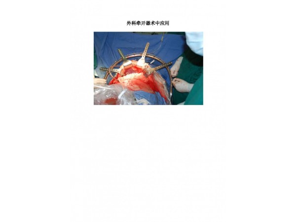 外科牽開器（框架拉鉤）