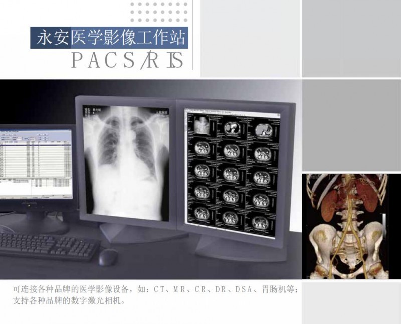 影像工作站（超聲、DR、CT、核磁）軟件廠家