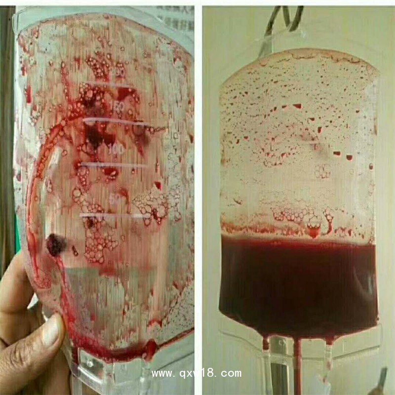 血袋、大自血血袋三大廠家南京賽爾金、蘇州萊仕、四川南格爾