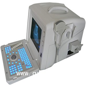 特價國產(chǎn)全數(shù)字B型超聲診斷儀