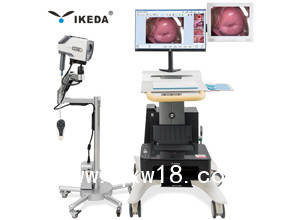 數(shù)碼電子陰道鏡 雙屏數(shù)碼電子陰道鏡