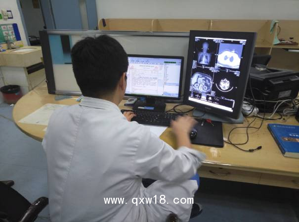 華益精點放射醫(yī)學(xué)影像診斷工作站