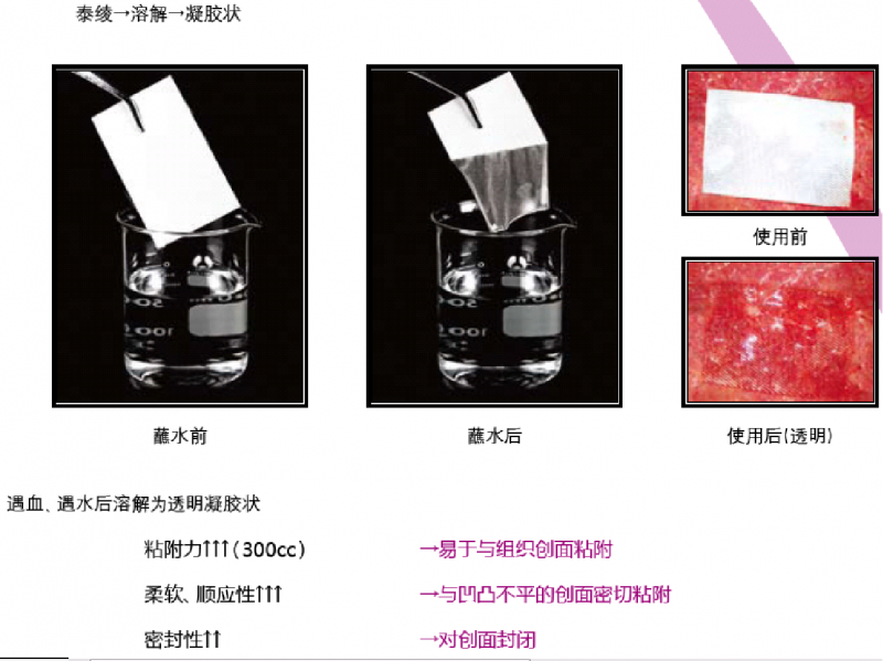 可吸收性止血紗布