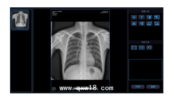 國內(nèi)品牌 移動式X光機 X射線拍片機