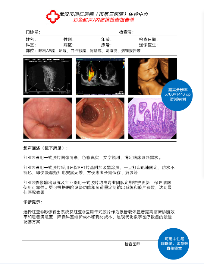 醫(yī)用干式膠片