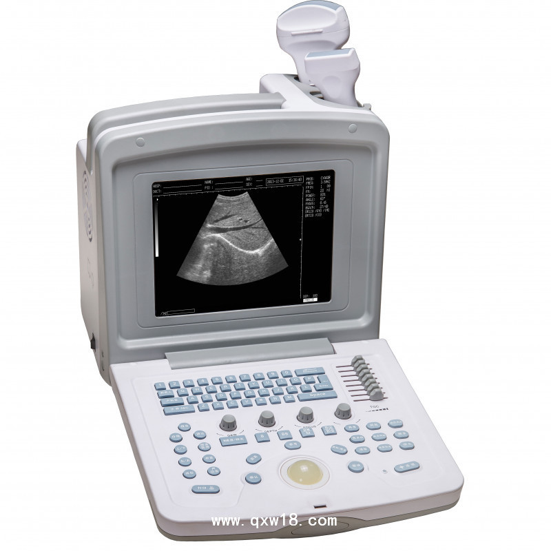 全數字超聲診斷系統(tǒng)