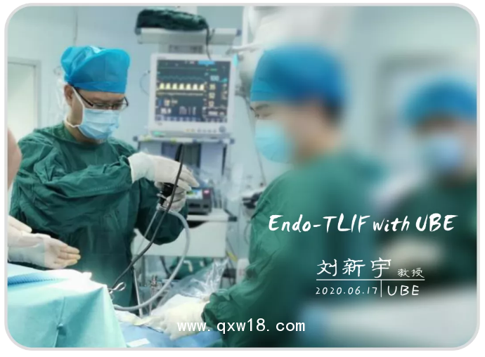 UBE全套脊柱手術(shù)器械