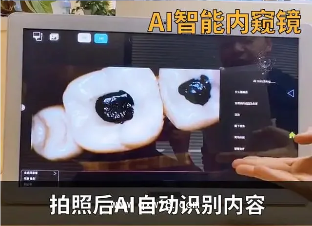 EZ·小雅口腔內(nèi)窺鏡